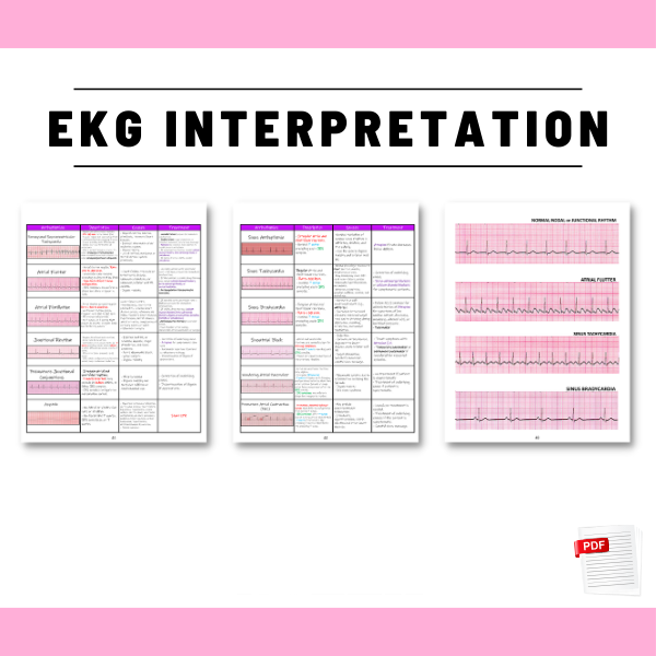 EKG & Dysrhythmia Interpretation Study Guide 2025–2026 - Cardiac Rhythms, Blocks & Arrhythmias Explained