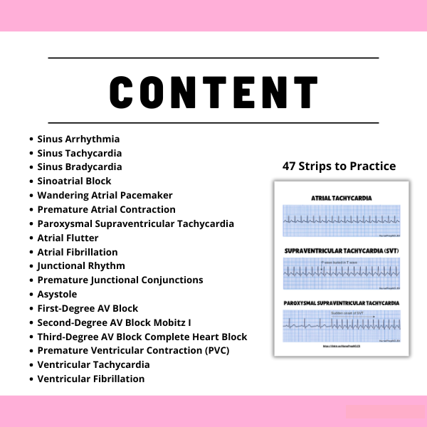 EKG & Dysrhythmia Interpretation Study Guide 2025–2026 - Cardiac Rhythms, Blocks & Arrhythmias Explained