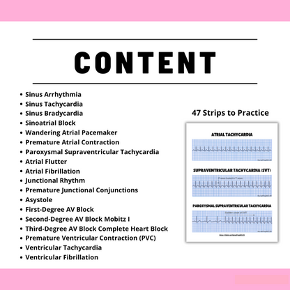 EKG & Dysrhythmia Interpretation Study Guide 2025–2026 - Cardiac Rhythms, Blocks & Arrhythmias Explained