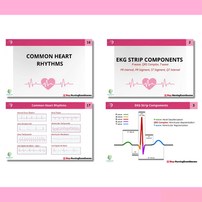 EKG & Dysrhythmia Interpretation Study Guide 2025–2026 - Cardiac Rhythms, Blocks & Arrhythmias Explained