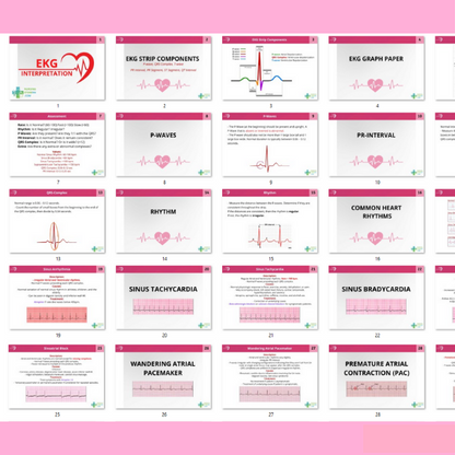 EKG & Dysrhythmia Interpretation Study Guide 2025–2026 - Cardiac Rhythms, Blocks & Arrhythmias Explained